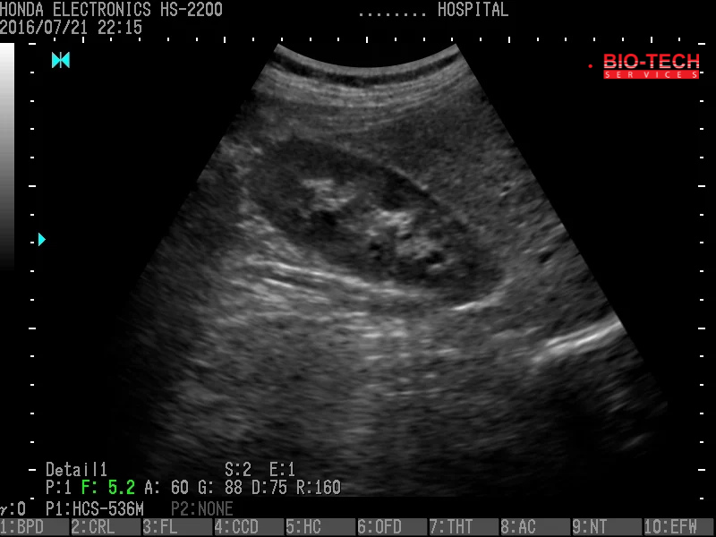 02 Kidney Detail 1