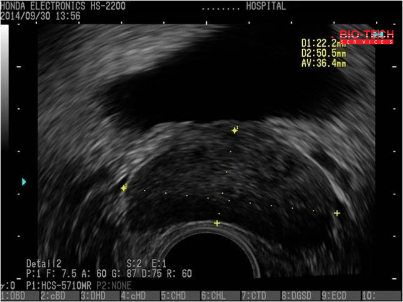 08 Bladder, prostate (transverse section) Detail 2