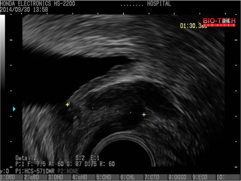 09 Bladder, prostate longitudinal section) Detail 2