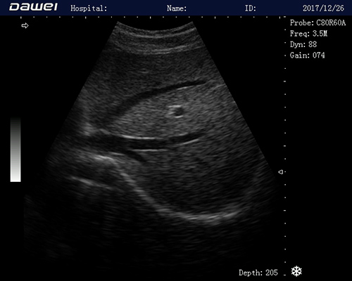 02 Liver DW-580, DAWEI