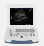 DAWEI DW-580 Portable Grayscale Ultrasound Machine