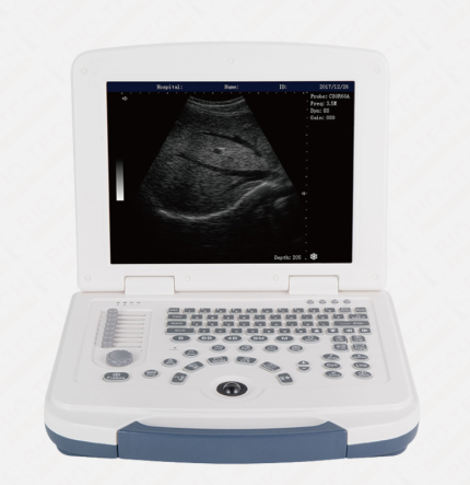 DAWEI DW-580 Portable Grayscale Ultrasound Machine