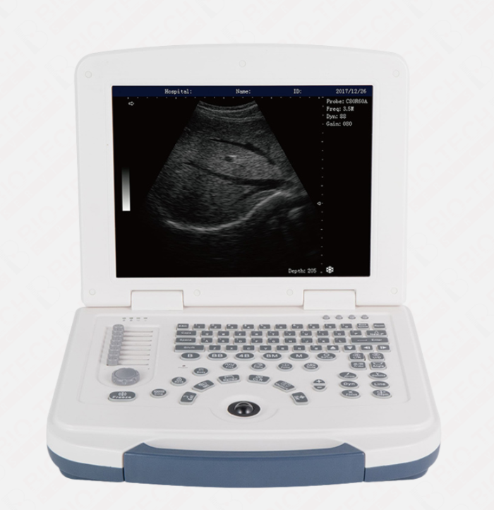 DAWEI DW-580 Portable Grayscale Ultrasound Machine - Image 1