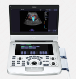 Edan AX3 Portable Color Doppler & Echocardiography System - Image 3