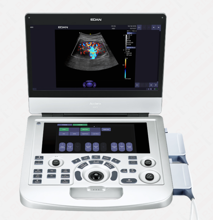 Edan AX3 Portable Color Doppler & Echocardiography System - Image 3