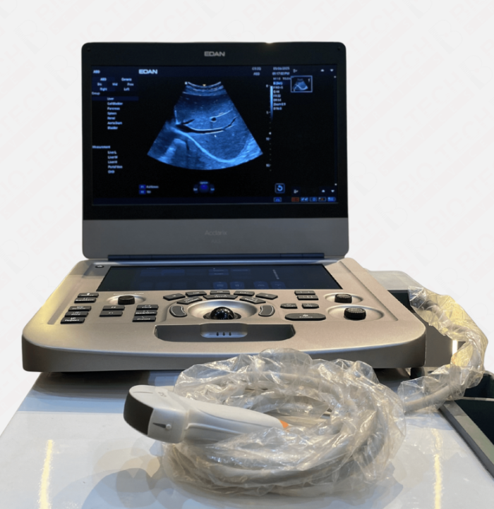 Edan AX3 Portable Color Doppler & Echocardiography System - Image 4