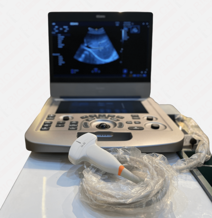 Edan AX3 Portable Color Doppler & Echocardiography System - Image 5