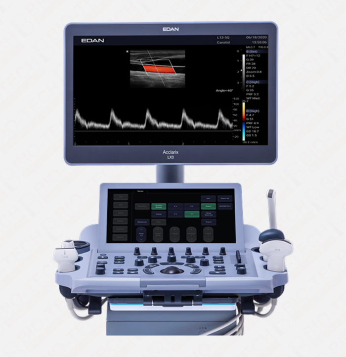 EDAN LX3 Color Doppler & Echocardiography Machine – Advanced Diagnostic Ultrasound - Image 3