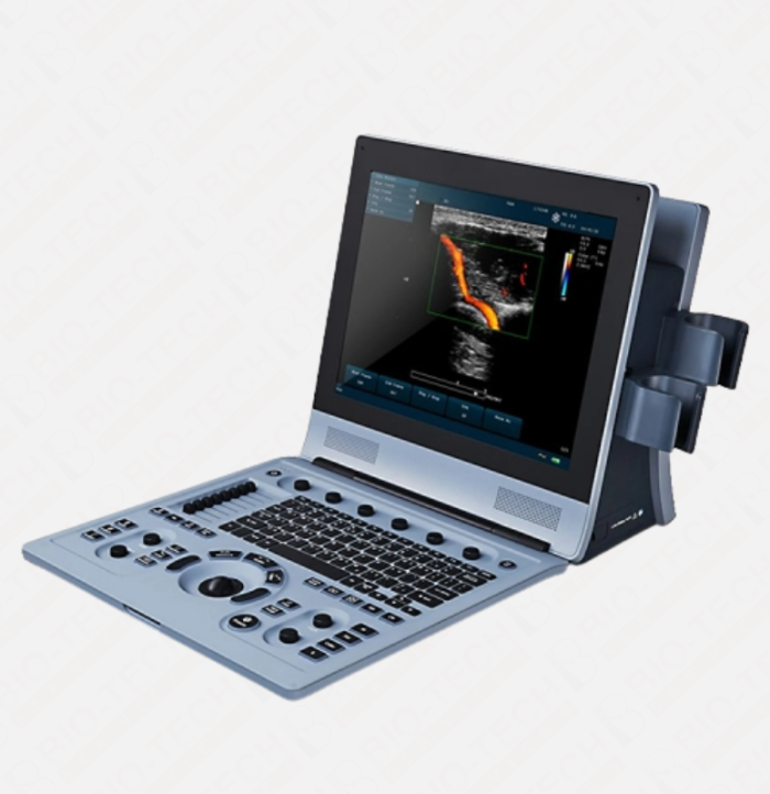 EDAN U60 Portable Color Doppler and Echocardiography Machine - Image 1