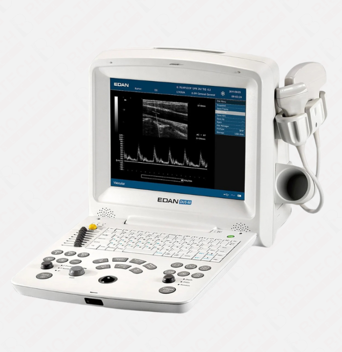 EDAN DUS-60 Grayscale Doppler Ultrasound Machine - Image 1
